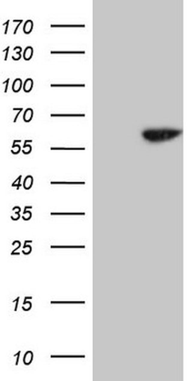 CDC6 Antibody in Western Blot (WB)