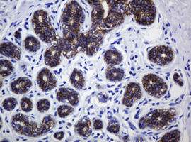 CDH1 Antibody in Immunohistochemistry (Paraffin) (IHC (P))