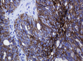 CDH1 Antibody in Immunohistochemistry (Paraffin) (IHC (P))