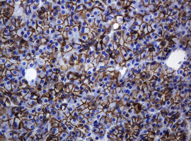 CDH1 Antibody in Immunohistochemistry (Paraffin) (IHC (P))