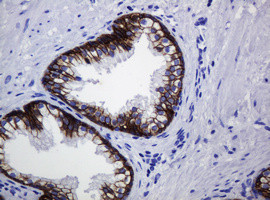 CDH1 Antibody in Immunohistochemistry (Paraffin) (IHC (P))