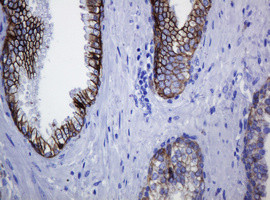 CDH1 Antibody in Immunohistochemistry (Paraffin) (IHC (P))