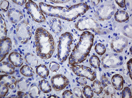 CDH1 Antibody in Immunohistochemistry (Paraffin) (IHC (P))