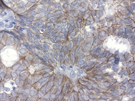 CDH1 Antibody in Immunohistochemistry (Paraffin) (IHC (P))