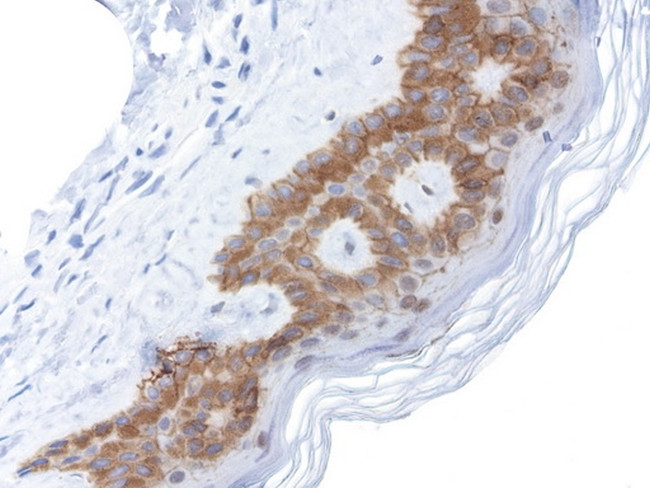 CDH1 Antibody in Immunohistochemistry (Paraffin) (IHC (P))