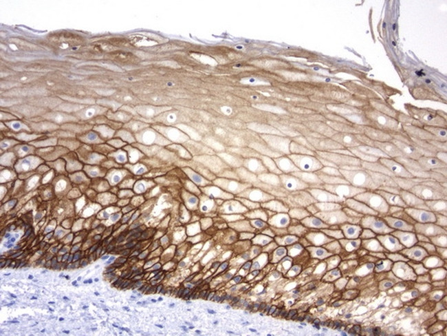 CDH1 Antibody in Immunohistochemistry (Paraffin) (IHC (P))