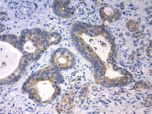 CDH1 Antibody in Immunohistochemistry (Paraffin) (IHC (P))