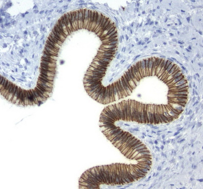 CDH1 Antibody in Immunohistochemistry (Paraffin) (IHC (P))