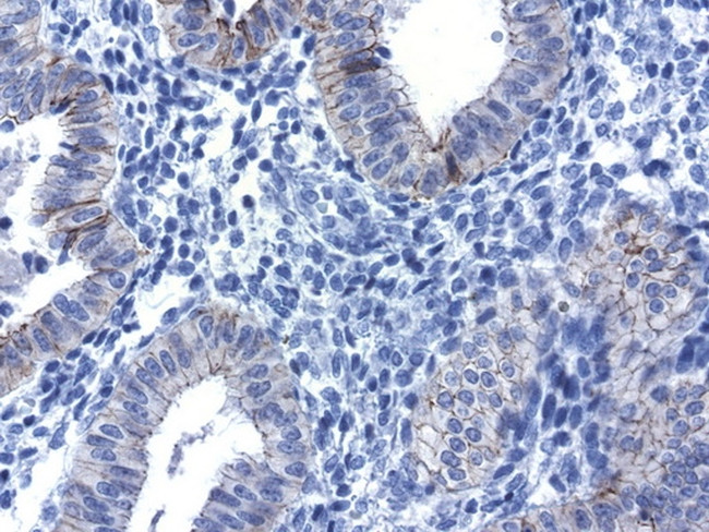 CDH1 Antibody in Immunohistochemistry (Paraffin) (IHC (P))