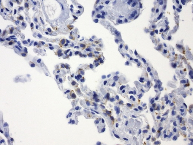 CDH1 Antibody in Immunohistochemistry (Paraffin) (IHC (P))