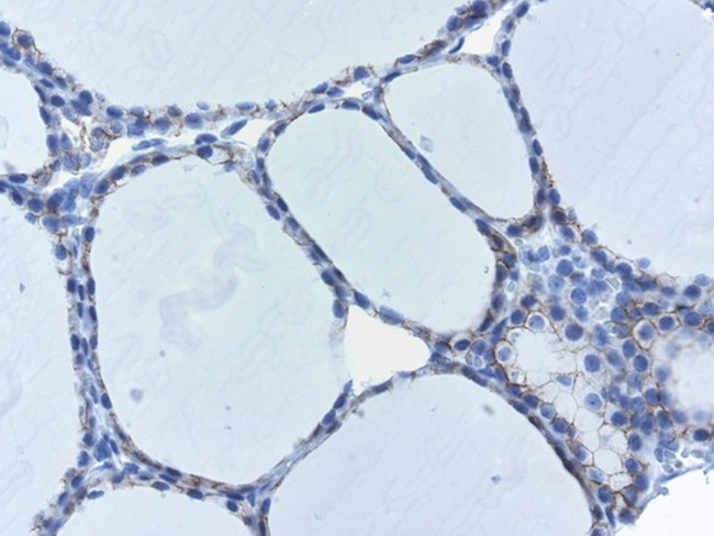 CDH1 Antibody in Immunohistochemistry (Paraffin) (IHC (P))