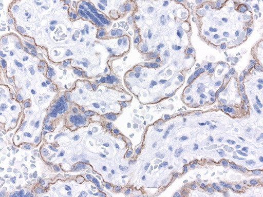 CDH1 Antibody in Immunohistochemistry (Paraffin) (IHC (P))