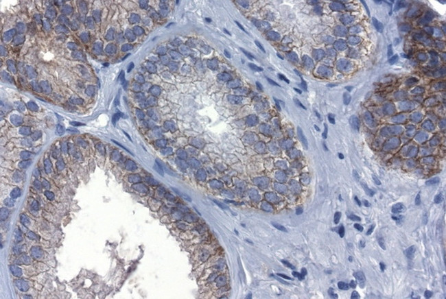 CDH1 Antibody in Immunohistochemistry (Paraffin) (IHC (P))