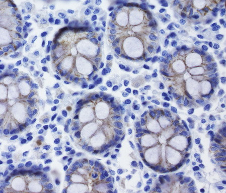 CDH1 Antibody in Immunohistochemistry (Paraffin) (IHC (P))