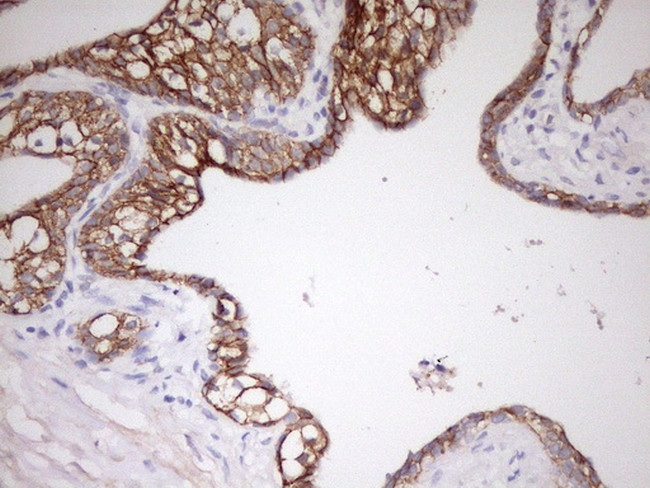 CDH1 Antibody in Immunohistochemistry (Paraffin) (IHC (P))