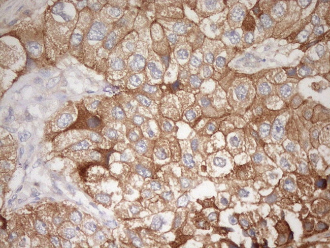 CDH1 Antibody in Immunohistochemistry (Paraffin) (IHC (P))