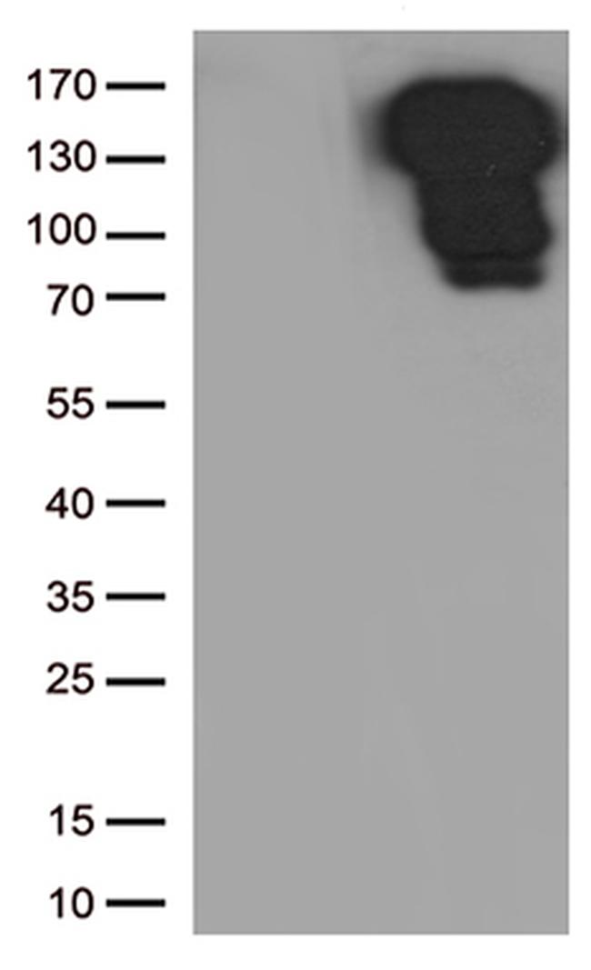 CDH1 Antibody in Western Blot (WB)