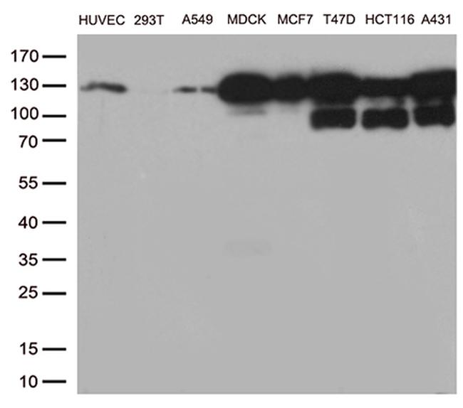 CDH1 Antibody in Western Blot (WB)