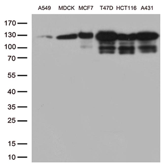 CDH1 Antibody in Western Blot (WB)