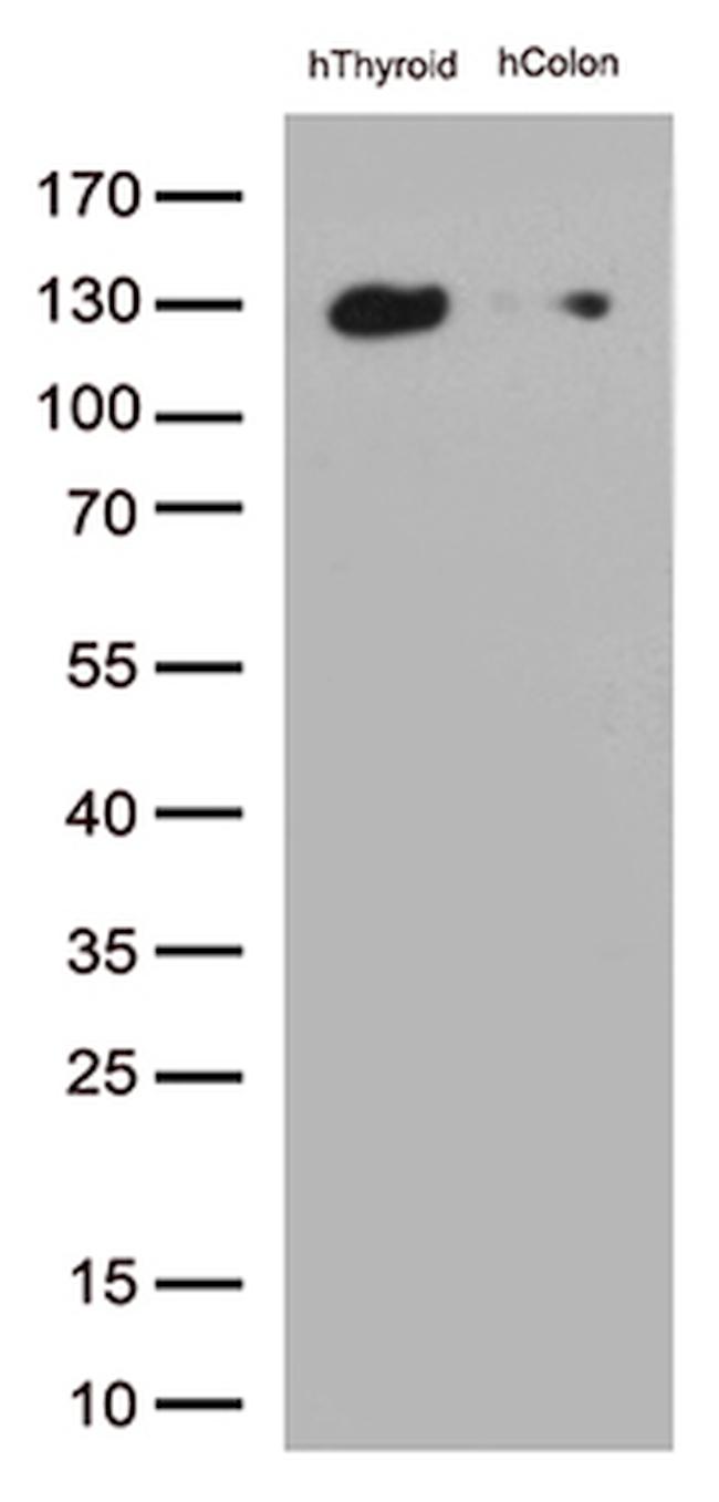 CDH1 Antibody in Western Blot (WB)