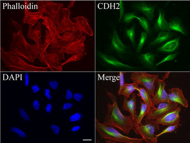 CDH2 Antibody in Immunocytochemistry (ICC/IF)