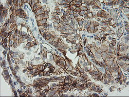 CDH2 Antibody in Immunohistochemistry (Paraffin) (IHC (P))