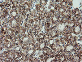 CDH2 Antibody in Immunohistochemistry (Paraffin) (IHC (P))