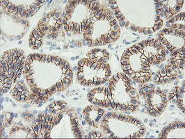 CDH2 Antibody in Immunohistochemistry (Paraffin) (IHC (P))