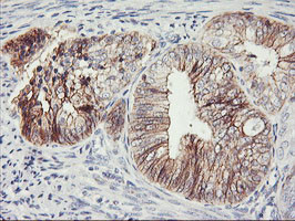 CDH2 Antibody in Immunohistochemistry (Paraffin) (IHC (P))