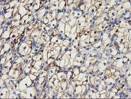 CDH2 Antibody in Immunohistochemistry (Paraffin) (IHC (P))