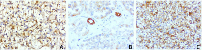 CDH2 Antibody in Immunohistochemistry (Paraffin) (IHC (P))