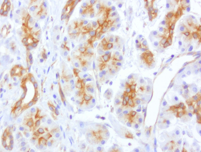 CDH2 Antibody in Immunohistochemistry (Paraffin) (IHC (P))