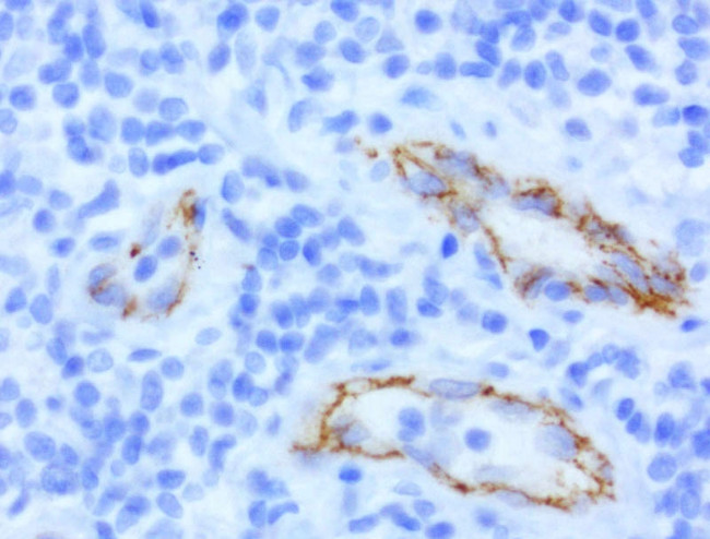 CDH2 Antibody in Immunohistochemistry (Paraffin) (IHC (P))