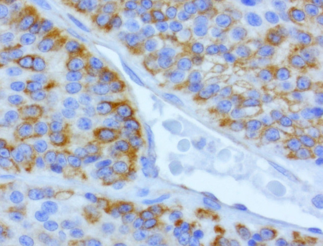 CDH2 Antibody in Immunohistochemistry (Paraffin) (IHC (P))