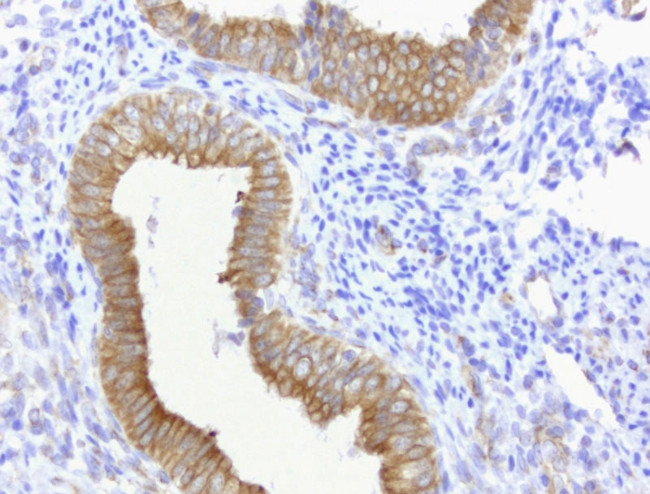 CDH2 Antibody in Immunohistochemistry (Paraffin) (IHC (P))