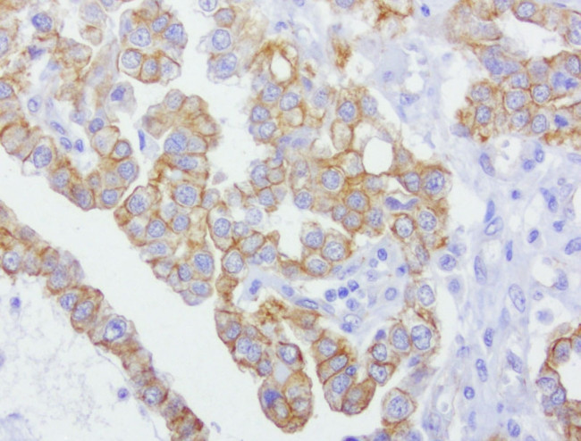 CDH2 Antibody in Immunohistochemistry (Paraffin) (IHC (P))