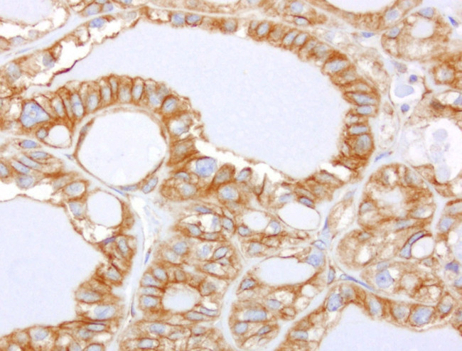 CDH2 Antibody in Immunohistochemistry (Paraffin) (IHC (P))