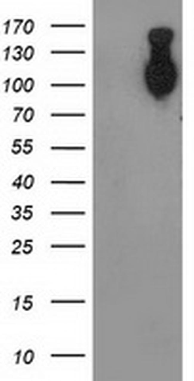 CDH2 Antibody in Western Blot (WB)