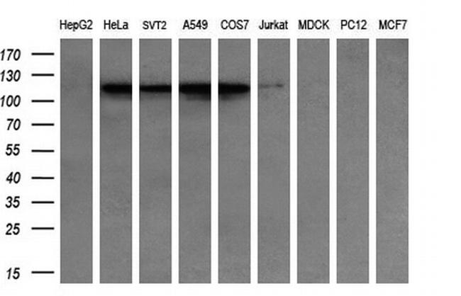 CDH2 Antibody in Western Blot (WB)