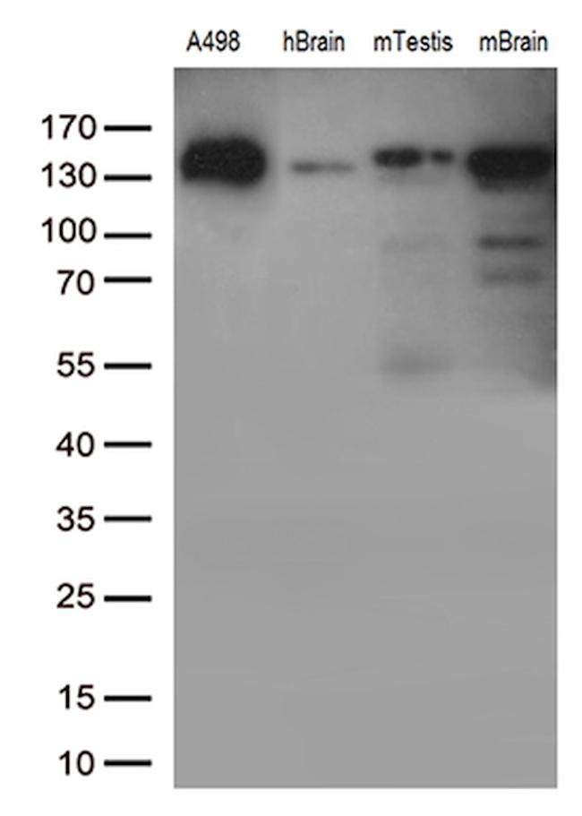 CDH2 Antibody in Western Blot (WB)