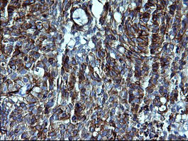 CDH3 Antibody in Immunohistochemistry (Paraffin) (IHC (P))