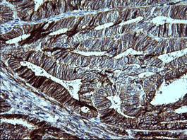 CDH3 Antibody in Immunohistochemistry (Paraffin) (IHC (P))