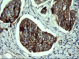 CDH3 Antibody in Immunohistochemistry (Paraffin) (IHC (P))