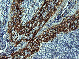 CDH3 Antibody in Immunohistochemistry (Paraffin) (IHC (P))