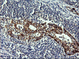 CDH3 Antibody in Immunohistochemistry (Paraffin) (IHC (P))