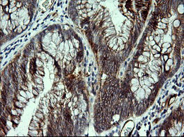 CDH3 Antibody in Immunohistochemistry (Paraffin) (IHC (P))