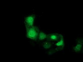 CDK2 Antibody in Immunocytochemistry (ICC/IF)