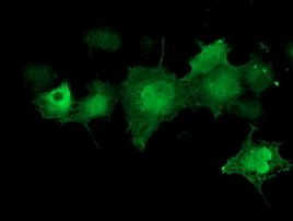 CDK2 Antibody in Immunocytochemistry (ICC/IF)