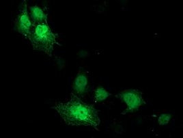 CDK2 Antibody in Immunocytochemistry (ICC/IF)