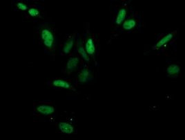 CDK2 Antibody in Immunocytochemistry (ICC/IF)